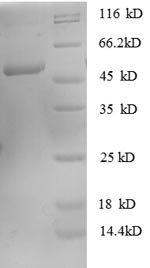 SDS-PAGE