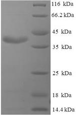 SDS-PAGE