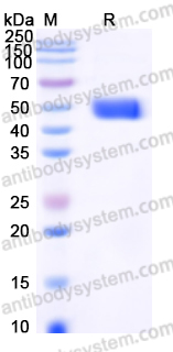 EHC00701, SDS-PAGE