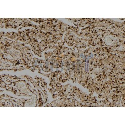 Валидация Affinity DF2954 - 13698