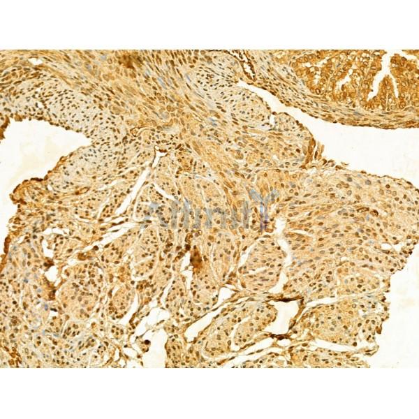 Валидация Affinity AF5161 - 2568