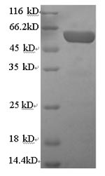 SDS-PAGE