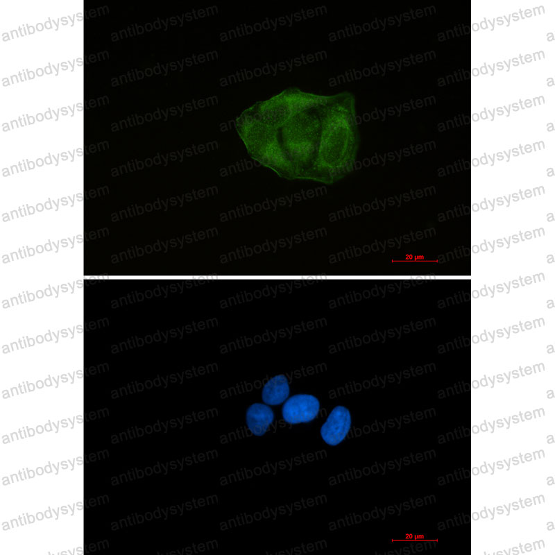 Валидация IF - AntibodySystem RHF56201