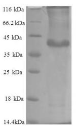SDS-PAGE