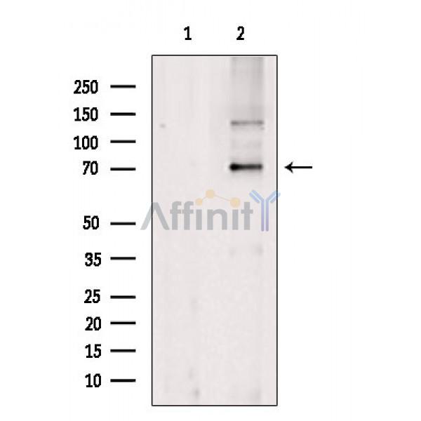Валидация Affinity DF4258 - 15648