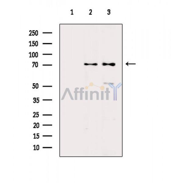Валидация Affinity DF2504 - 13155
