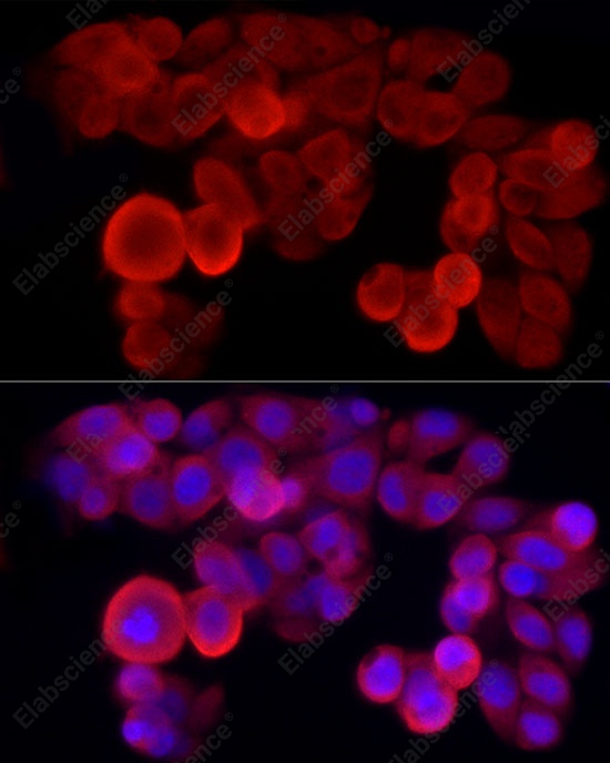 Иммунофлуоресценция, NLRP3, клетки HepG2