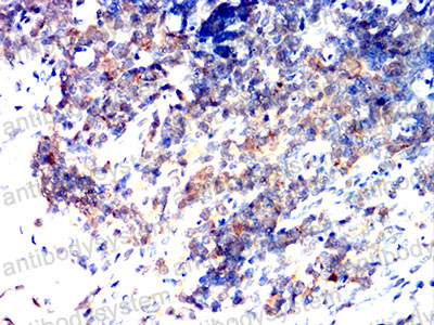 Валидация AntibodySystem RHG13208