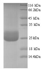 SDS-PAGE
