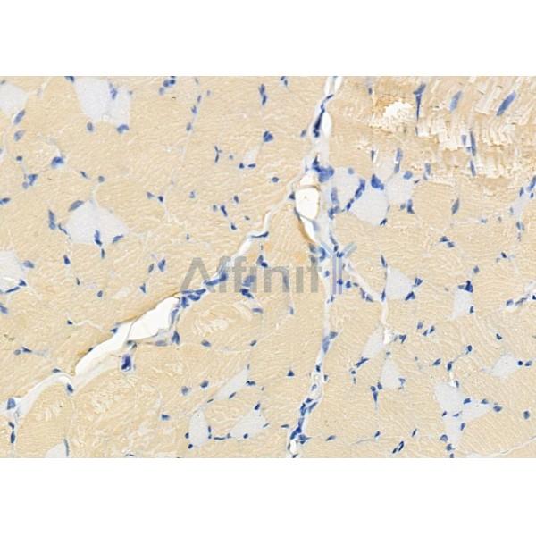 Валидация Affinity DF8692 - 20674