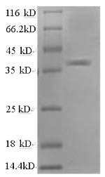 SDS-PAGE