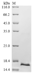 SDS-PAGE