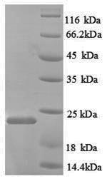 SDS-PAGE