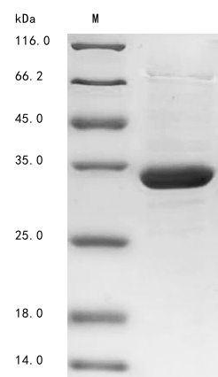 SDS-PAGE