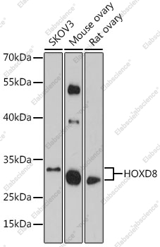 Вестерн-блоттинг, HOXD8, различные клеточные линии