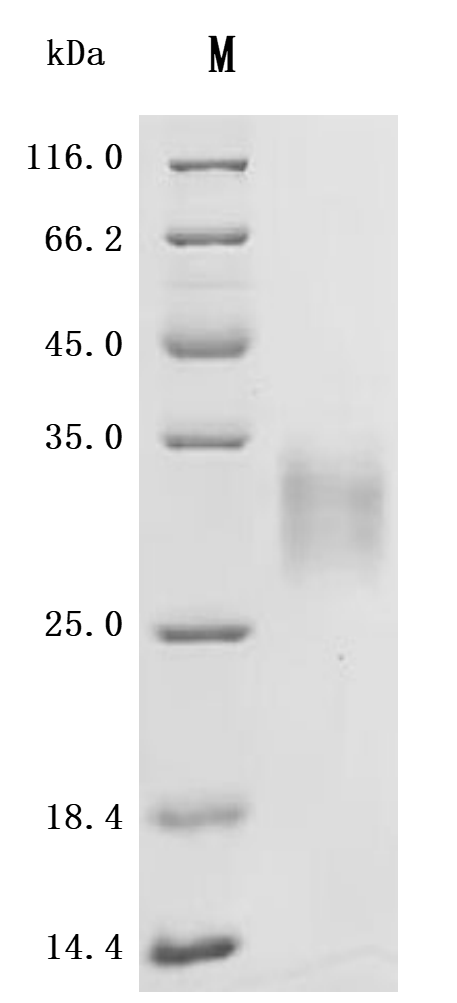 SDS-PAGE