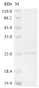 SDS-PAGE