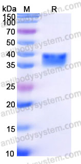 AHD63602, SDS-PAGE