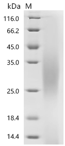 SDS-PAGE