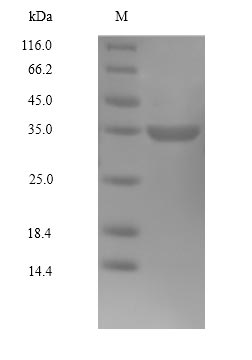 SDS-PAGE