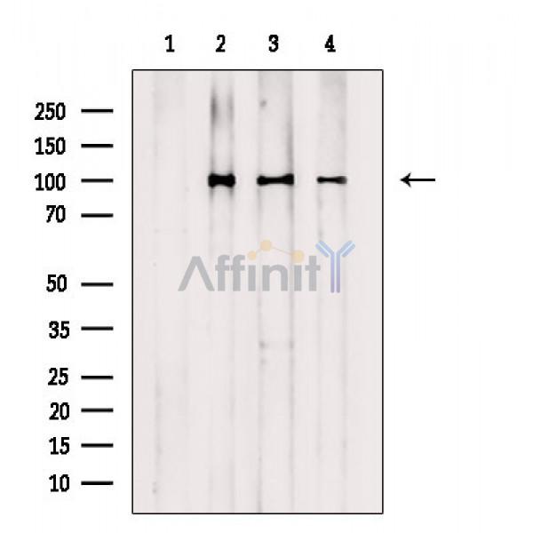 Валидация Affinity AF6820 - 4058