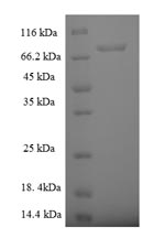 SDS-PAGE
