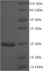 SDS-PAGE