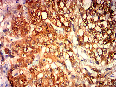 Валидация AntibodySystem RHE41903