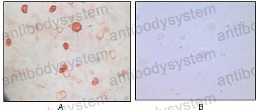 Валидация AntibodySystem RVV44301 (4204)