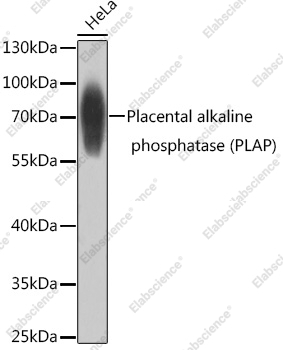 Вестерн-блоттинг, Placental alkaline phosphatase, клетки HeLa