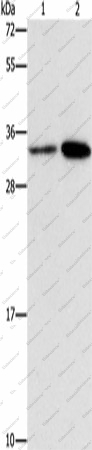 Вестерн-блоттинг, CDC34, клетки HeLa и A431