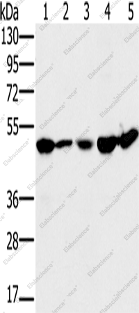 Вестерн-блоттинг, PSMC2, клетки 231, Jurkat, 293T, HeLa и ткань печени мыши