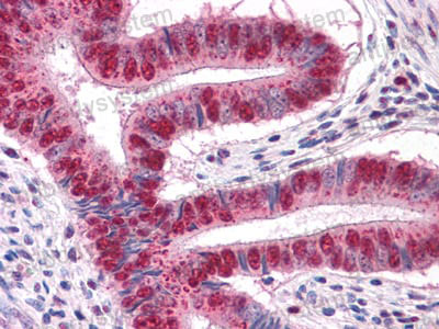 Валидация AntibodySystem RHH52401