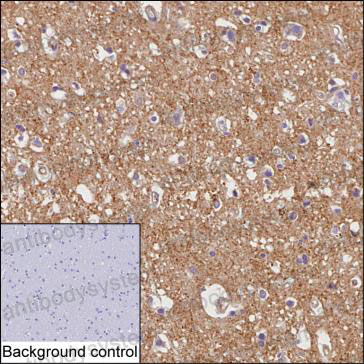 Валидация AntibodySystem RHH32902