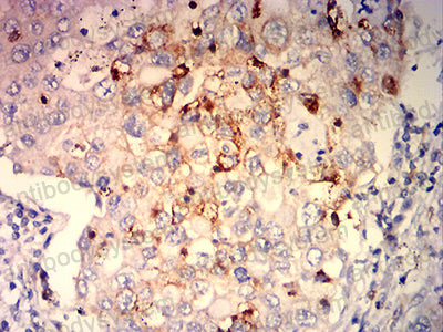 Валидация AntibodySystem RHD69203 (1723)