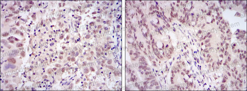 Валидация AntibodySystem RHE78703