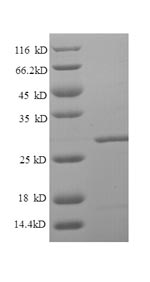 SDS-PAGE