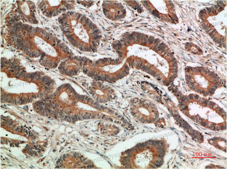 Валидация AntibodySystem RHC16507 (698)