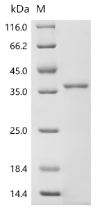 SDS-PAGE