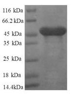 SDS-PAGE