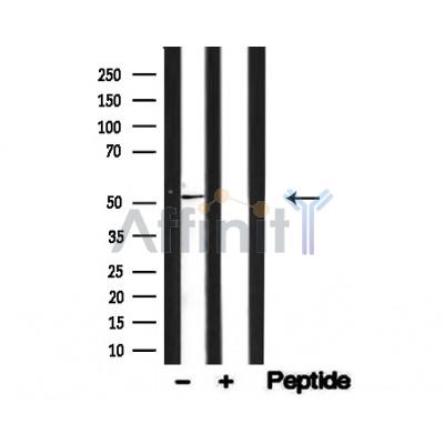 Валидация Affinity AF4651 - 2264