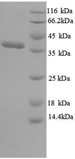SDS-PAGE