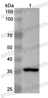 Валидация AntibodySystem PHB80601