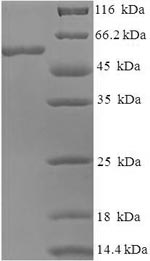 SDS-PAGE