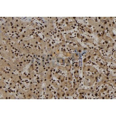 Валидация Affinity DF6968 - 18590