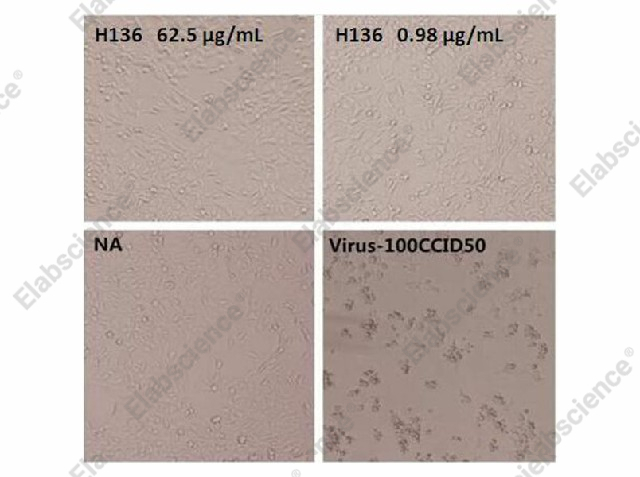 Микронейтрализация, Enterovirus 71 VP1, клетки RD