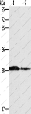 Вестерн-блоттинг, SPR, ткань опухоли хромаффинных клеток человека и клетки Lovo