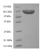 SDS-PAGE