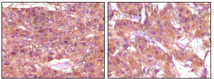Валидация AntibodySystem RHN33501
