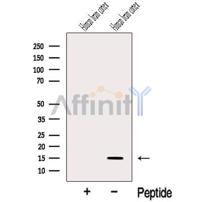 Валидация Affinity DF12544 - 7149